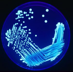 GTR_Legionella